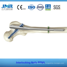 Gamma Nails Orthopädische Implantat Pfna Interlocking Nails